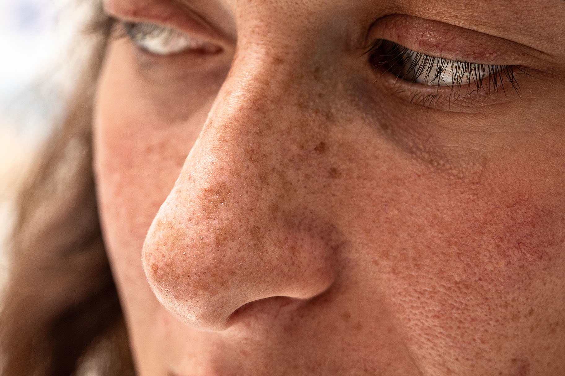 close-up of a woman’s nose and cheek showing visible freckles and sunspots