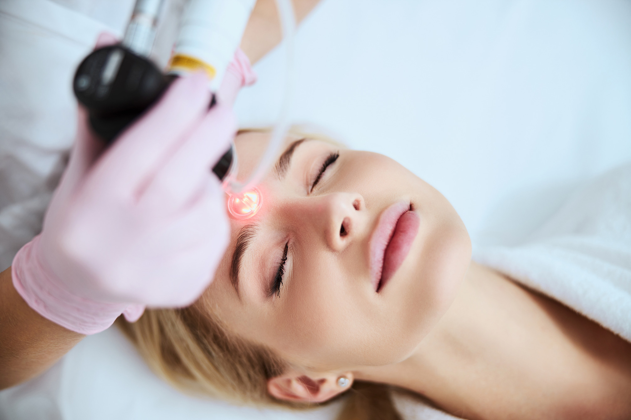Gloved hand holding a laser device near a woman’s forehead while she lies on a treatment bed.
